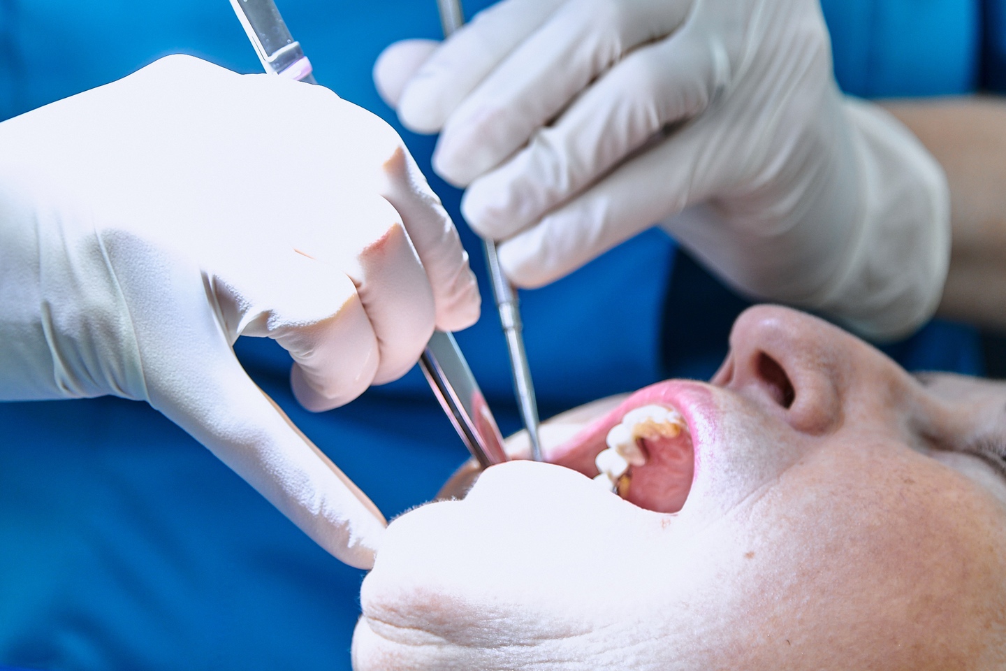 Marcador de posición