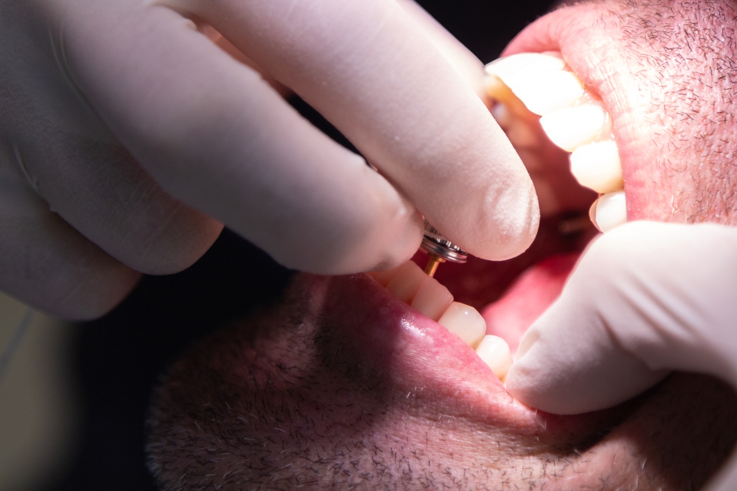 Marcador de posición