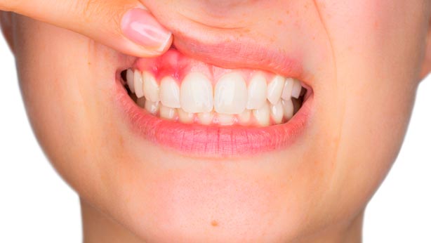 Marcador de posición