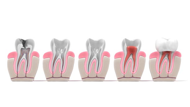 Marcador de posición